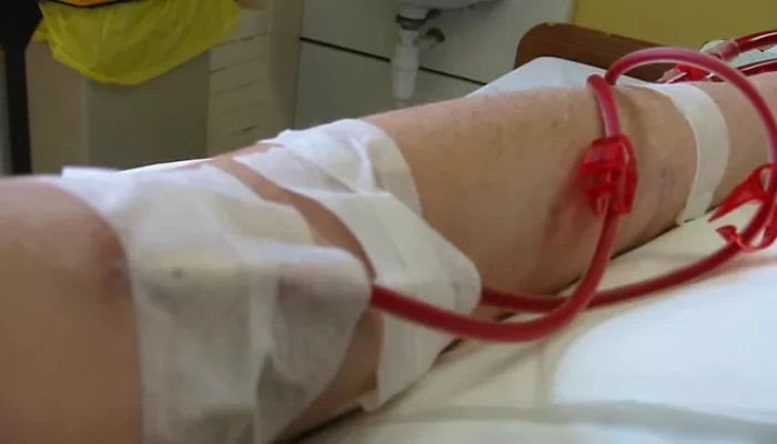 قتل للمرضى الفقراء... رفع سعر جلسة الغسيل الكلوي من 685 إلى 1200 جنيه
