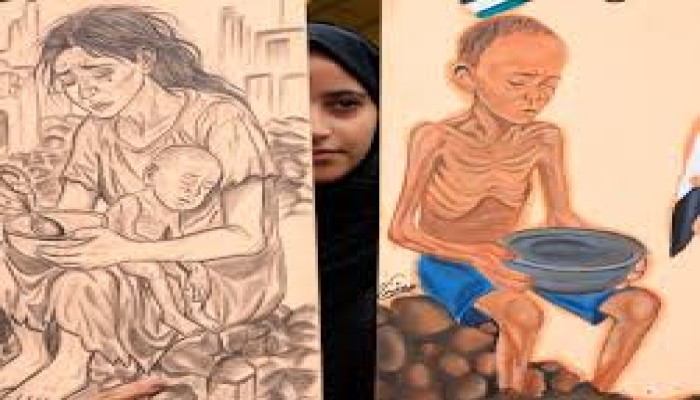 الجارديان || في اليمن كما في غزة: القنابل والمجاعة تسلب أطفالنا حياتهم
