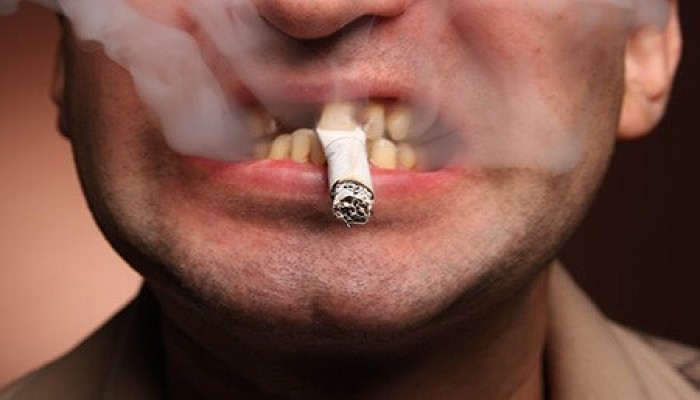 5 عادات يومية تزيد خطر الإصابة بسرطان الفم 