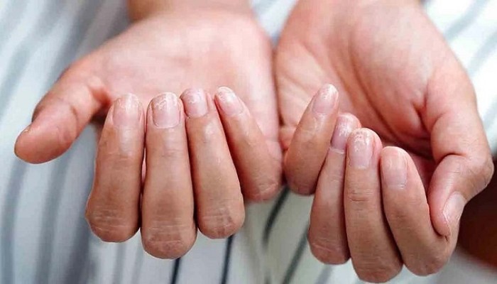 أسباب الشعور ببرودة اليدين والقدمين باردة وكيفية علاجها