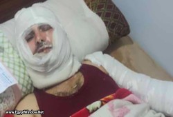 خلاف على ملكية منزل يتحول إلى ساحة عنف وحريق في كفر الشيخ.. 5 مصابين ورعب بين الأهالي