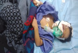 عقر 3 أطفال في الفيوم يشعل جرس الإنذار.. كلاب الشوارع تحاصر المواطنين من القرى إلى قلب المدن