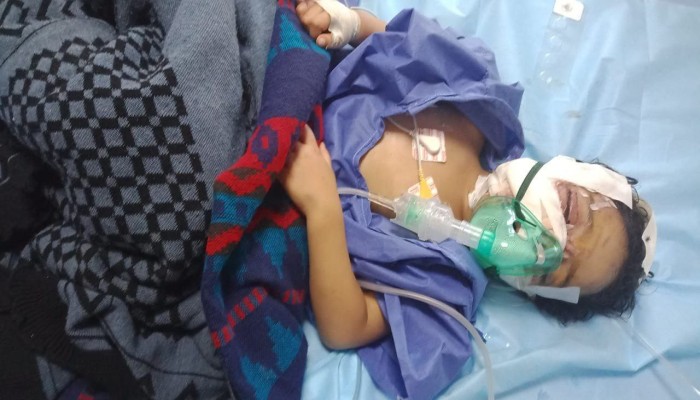 عقر 3 أطفال في الفيوم يشعل جرس الإنذار.. كلاب الشوارع تحاصر المواطنين من القرى إلى قلب المدن