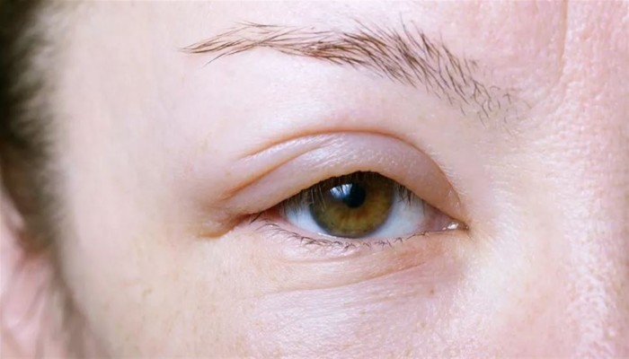 طرق فعالة لمحاربة انتفاخ العينين في فصل الشتاء