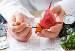 تقنيىة جديدة لعلاج سرطان البروستاتا دون آثار جانبية 