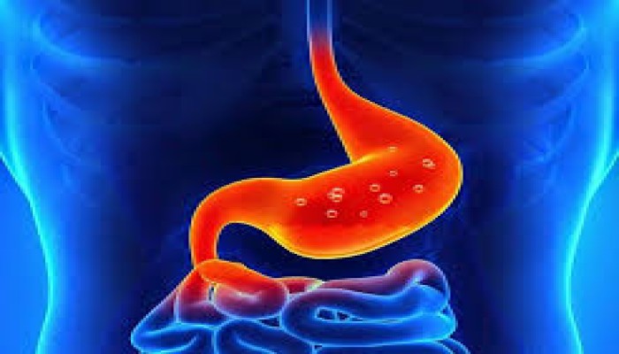 انتبه.. أطعمة ومشروبات وتمارين تسبب ارتجاع المريء 