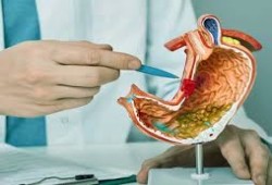 أسباب الإصابة بسرطان الأمعاء وعلامات الخطر