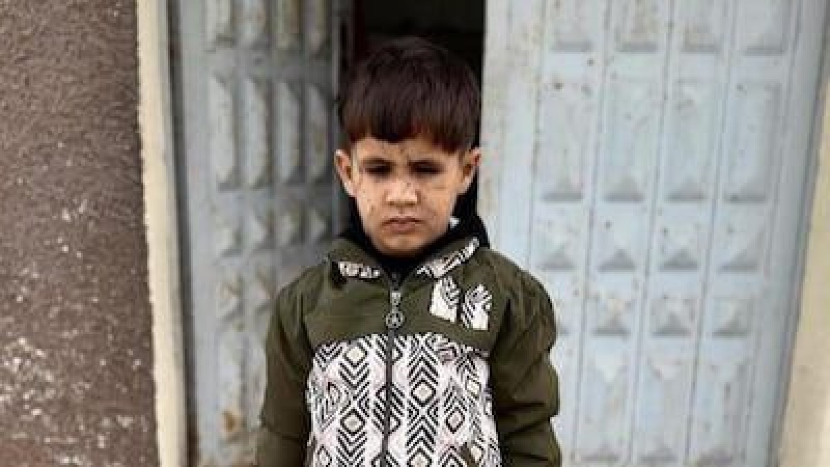 ذا ناشيونال || آلاف في غزة يواجهون خطر فقدان البصر بسبب نقص العلاج