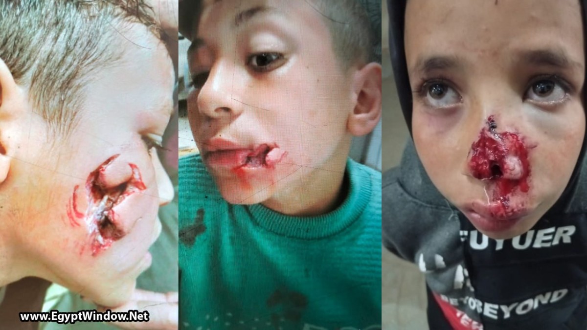 سلعوة تثير الرعب في بني سويف وتصيب 6 أطفال بإصابات خطيرة