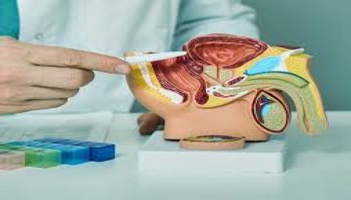 6 علامات لسرطان البروستاتا.. احذر تجاهلها 