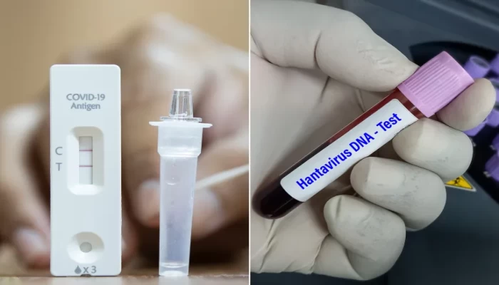 13 سؤالاً وإجاباتها توضح الفرق بين هانتا وكورونا.. وهل من داع للقلق؟