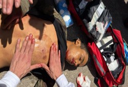 “دماء الأطفال تحت النار والجوع”.. تصعيد إسرائيلي في الضفة وغزة بين القتل والتجويع وتدمير مقومات الحياة