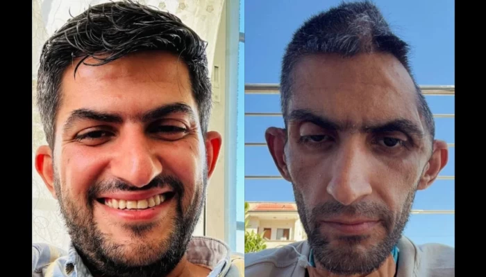 ميدل إيست آي|| صور صحفي فلسطيني بعد الإفراج عنه من السجون الإسرائيلية تثير موجة غضب واسعة