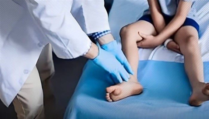 عذاب أطفال «دوشين» بين عضلات تنهار وعلاج بالملايين.. كيف نزعت الحكومة الأمل من الصغار وحولت مرضهم لعجز دائم؟