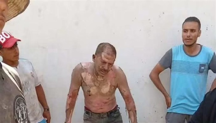 بسبب إزالة كشكه.. فيديو || مواطن يشعل النار في نفسه ببورسعيد
